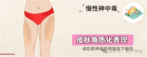 图片细节